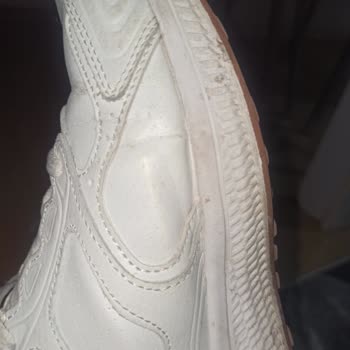 3 Ayda Skechers Ayakkabı Kullanılamaz Hale Geldi