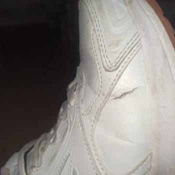 3 Ayda Skechers Ayakkabı Kullanılamaz Hale Geldi