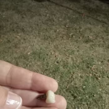 AFK Diş Kliniği Düşen İmplantı Yerine Takmak İçin 2000TL İstedi Afk Diş Polikliniği