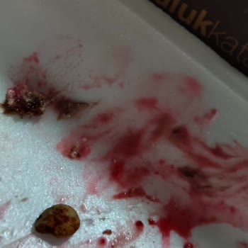 Liva Pastanesi (livashop.com) Pastadan Çıkan Taş Ve Plastik Parçası