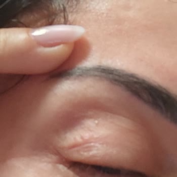 Maruderm Serum Alerji Yaptı