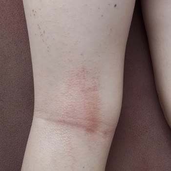 İncia Sinek Kovucu Sprey Hk