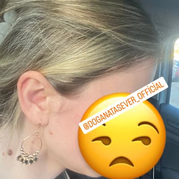 Dogan Atasever Hair Doctor Yanıltmacası