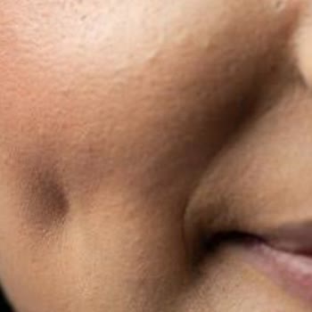 Rubella Estetic Center Gamze Estetiği Faciası