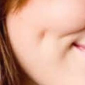 Rubella Estetic Center Gamze Estetiği Faciası