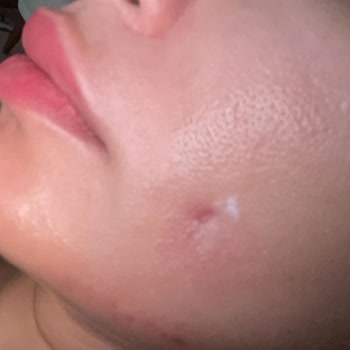 Rubella Estetic Center Gamze Estetiği Faciası