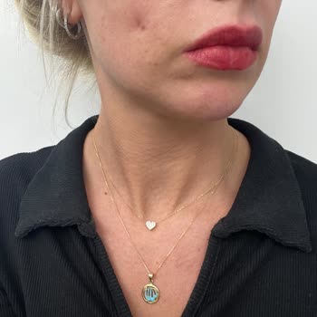 Rubella Estetic Center Gamze Estetiği Faciası