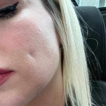 Rubella Estetic Center Gamze Estetiği Faciası