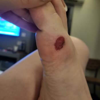 Oysho Terlik Ayakkabısı İncelemesi