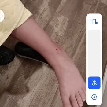 Airbnb Ev Sahibinin İhmali Sonucu Çocuğumuz Yaralandı Ve Haksız Bir Şekilde Tazminat Talep Ediliyor