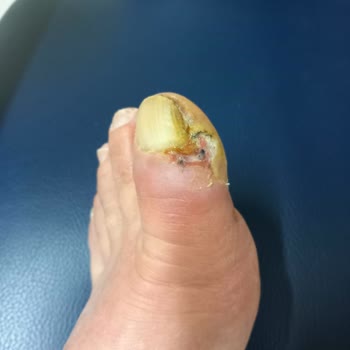 Echomar Doktor İhmali Sonucu