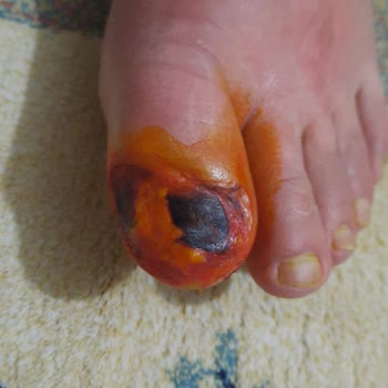 Echomar Doktor İhmali Sonucu