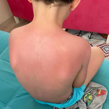 BİM Angie Güneş Kremi Çok Kötü