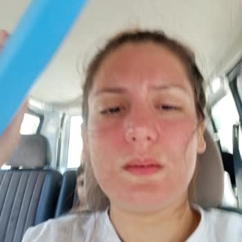 Yves Rocher Maske Cilt Alerjisi