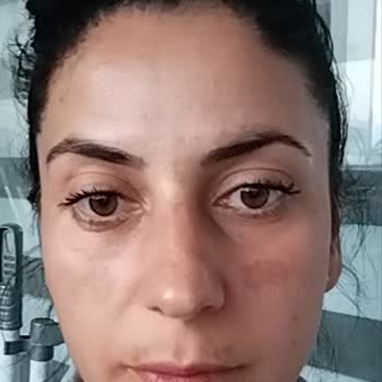 Luis Bien Güneş Kremi Yeni Lekeler Oluşturdu