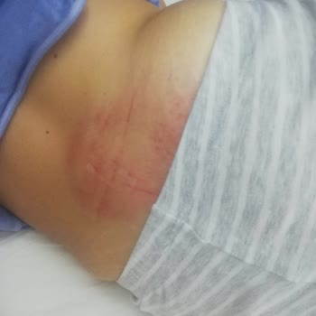 Akyalı Butik Otel (Bodrum) Güvenlik Önlemi Zafiyeti