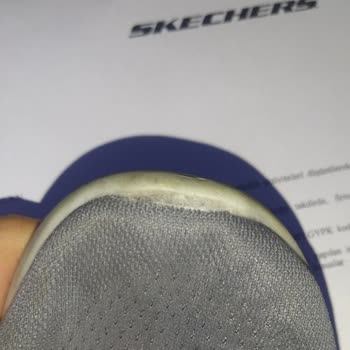 Skechers Shoes Fall Apart Within a Month, Disappointing Post-Purchase Support
