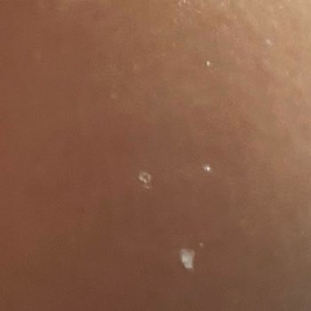 Sleepy Kimyasalları Cilde Yapışıyor