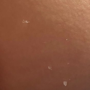 Sleepy Kimyasalları Cilde Yapışıyor