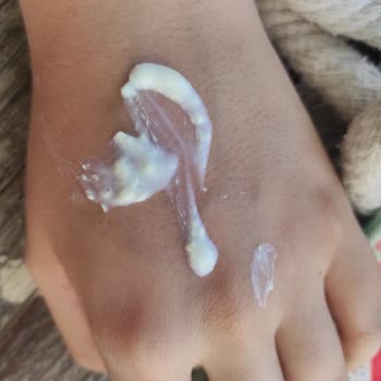 Nivea Güneş Kremi Bozuk Çıktı