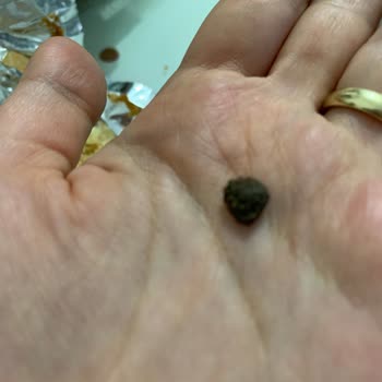 BİM'den Aldığımız Casey Meyveli Kekten Taş Çıktı