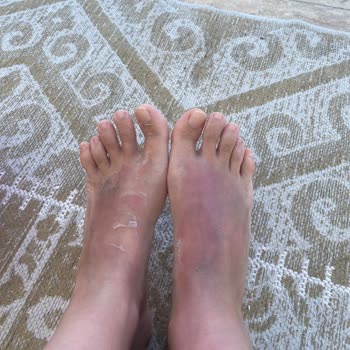 Sebamed 50 SPF Güneş Koruyucu Tüm Vücudum Yanık İçinde