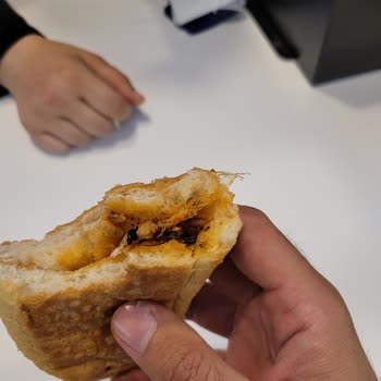 Yaprak Dönercisi Dönerin İçinden Yabancı Cisim Çıkması