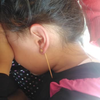 Nomanoğlu Kuyumculuk Küpenin Vidası Kızımın Kulağına Gömüldü