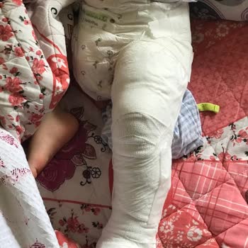 Zile Devlet Hastanesi Hastanede Yanlış Müdahale