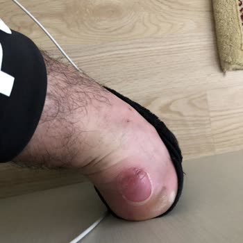 Papuckoolik (İnstagram) Papuckoolik Ayaklarımı Yara İçinde Bıraktı