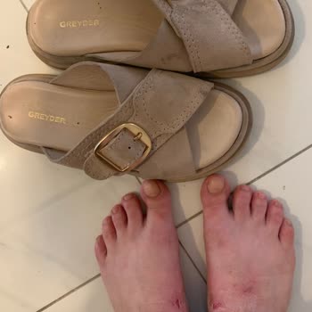 Greyder Terlik Ayağımı Yara Yaptı