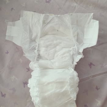 Baby Turco Bebek Bezinin İçinde Sinek Var