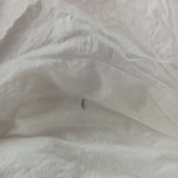 Baby Turco Bebek Bezinin İçinde Sinek Var