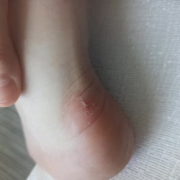 A101 İnternet Alışverişinde Adidas Ayakkabıda İade Mağduriyeti