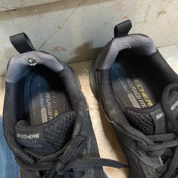 Skechers Kullanıcı Hatası Saçmalığı