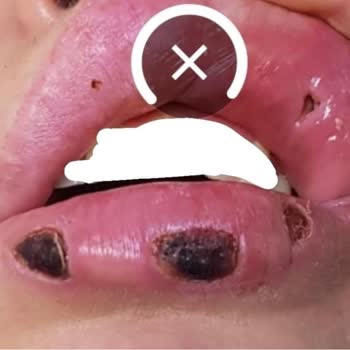 Dr. Hüseyin Tırman Polikliniği  Yaptığı İşlemden Memnun Kalmadım!