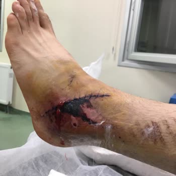 Yargıtay Başkanlığı Gelmeyen Dosya Sırası