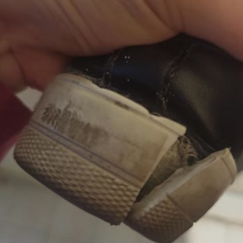 BTM Moda Bin 2 Hafta Da Paramparça Olan Ayakkabıları