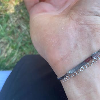 Ern Silver Kopma Ve Kararma