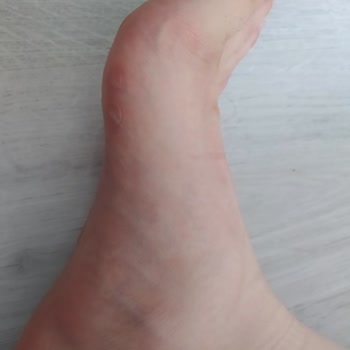 Elle Ayakkabı Terlik İade Alınmaması