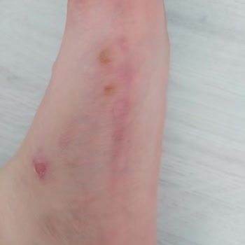 Elle Ayakkabı Terlik İade Alınmaması