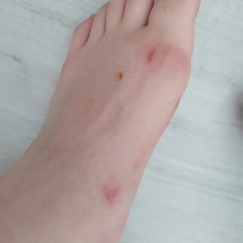 Elle Ayakkabı Terlik İade Alınmaması