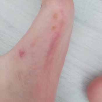 Elle Ayakkabı Terlik İade Alınmaması