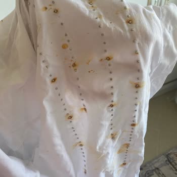 Refka Yıkama Talimatına Göre Taş Kısmı Paslanmış Tunik