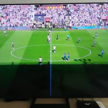 Digiturk Yayın Kalitesi Yetersizliği