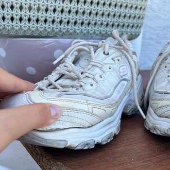 Skechers Ayakkabı Önü Açılması