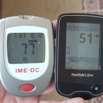 Freestyle Libre  Sensör Ölçüm Değerleri
