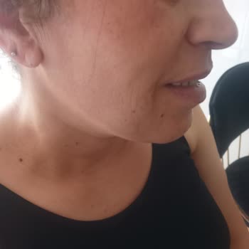 Awera Güzellik Ve Estetik Kolajen Cilt Bakımı İşlemi!