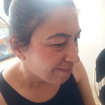 Awera Güzellik Ve Estetik Kolajen Cilt Bakımı İşlemi!