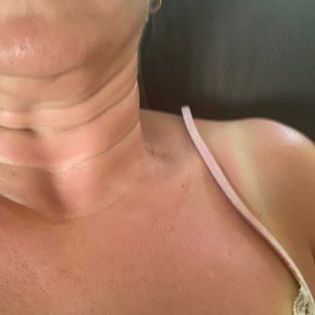 Eda Taşpınar Bronzlaştırıcı Yağ Ve Haşlanma